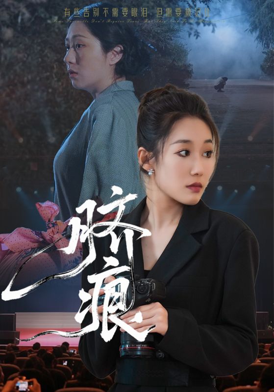 脐痕